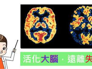 「阿茲海默症」是可以預防的：「腦部活化三運動」多走、多想、多睡，讓你的「腦齡」步步高！