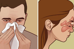 「過敏」一發作鼻涕擤不完？8個「天然妙招」幫你打擊過敏，大口呼吸不是夢！