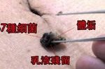 肚臍內含「67種細菌」等著攻擊！醫：遏止發黑飄惡臭，「凹凸」肚臍清潔兩者有別！