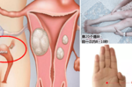 氣色不佳？月經不調？「宮寒」惹的禍！每天推肝經、按摩「5穴道」子宮回暖身體好｜每日健康Health