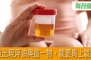 尿液上有一層浮油，是什麼病？專家：看到浮油搭上這一物，不馬上就醫不行！