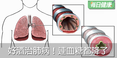 氣管病能喝酒？活血潤肺３步驟，改善有成！｜每日健康 Health