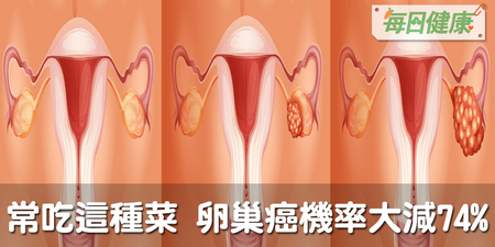 女人常吃這種菜，不只凍齡更能逆齡，罹患卵巢癌機率大降74％！｜每日健康 Health