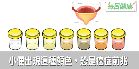 注意，小便出現這顏色是癌症前兆！一次看懂7種尿液顏色的隱藏疾病｜每日健康 Health