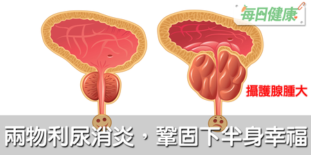 咖啡不能天天喝，小心攝護腺越腫越大！多吃消炎兩物，下半身幸福穩妥當｜每日健康 Health