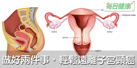 生理期吃冰的，容易得子宮頸癌？醫師：兩件事做好，才是預防癌症的不二法門｜每日健康 Health