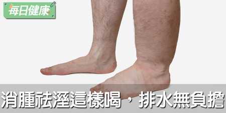 整天水腫看起來當然胖！天然除濕機來了：這樣喝祛溼、消水腫，修長美腿Get｜每日健康 Health