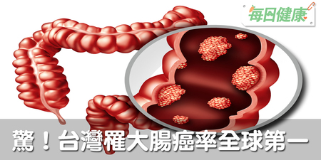 恐怖！大腸癌年奪5000命，快吃6大護腸美食補滿防癌力，從此和腸癌斷絕關係｜每日健康 Health