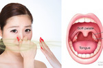 口腔的「味道」能看出您身體出什麼問題，口腔常常有「異味」？有可能是因為患有「扁桃腺結石」！