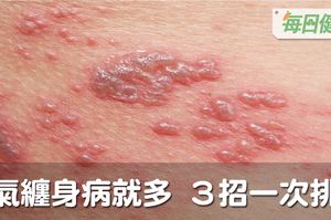 濕氣纏身病就多，脂肪肝、血壓飆高都來了！學會3招一次排光體內濕毒｜每日健康Health