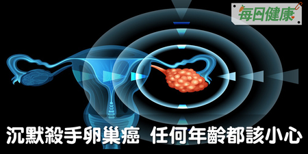 80%一發現就是晚期！女性殺手卵巢癌惡化超快，輕忽10大早期症狀恐致命｜每日健康 Health