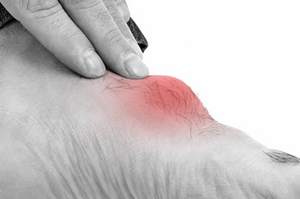 痛風只注意尿酸值還不夠！醫師囑咐：秉持五吃五不吃，病發疼痛降至無感｜每日健康 Health