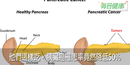 只是這樣吃，「沉默殺手」胰臟癌罹患率竟然降低50%，5 種高危險族群更是不可不看