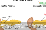 只是這樣吃，「沉默殺手」胰臟癌罹患率竟然降低50%，5 種高危險族群更是不可不看