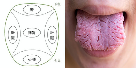 身體好不好，看「舌頭」最準！中醫：9種病，教你一張圖秒判定，不看會後悔｜每日健康 Health