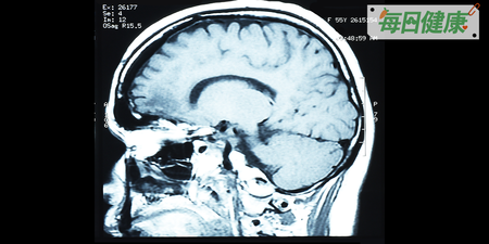 一名15歲國中生，突發半夜頭痛痛到驚醒，伴隨著噁心嘔吐，竟然是「這個疾病」！｜每日健康 Health
