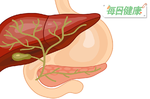 「膽管癌」患者7成活不過五年！7大危險因子一次詳解｜每日健康 Health