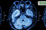 13歲女童頭痛持續兩周當感冒，竟是可怕「室管膜瘤」，嚴重可能猝死｜每日健康 Health