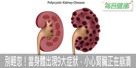 別輕忽！腎臟病變毫無疼痛感，當身體出現9大症狀，小心腎臟正在崩潰｜每日健康 Health