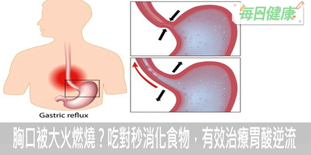 胸口被大火燃燒？吃對幾種秒消化食物，自體擊退胃酸逆流｜每日健康 Health