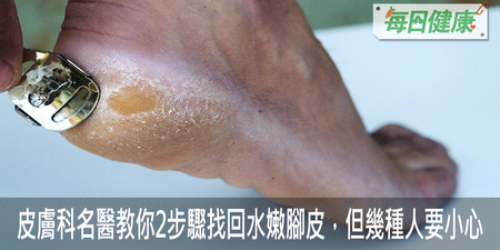「腳底厚皮」醜醜的？皮膚科名醫教你2步驟找回水嫩腳皮｜每日健康 Health
