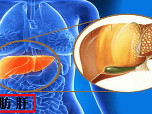 血脂一高肝就中招，不要再讓肝哭泣了！少吃這些食物，「脂肪肝」也可逆轉勝！