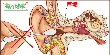 耳膜破裂案例激增，醫師警告：別再用棉花棒挖耳朵了，小心挖到失聰｜每日健康 Health