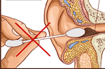 耳膜破裂案例激增，醫師警告：別再用棉花棒挖耳朵了，小心挖到失聰｜每日健康 Health