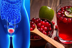 膀胱炎真的好困擾！這四種天然食物可以「保護膀胱」減少「尿路感染」！