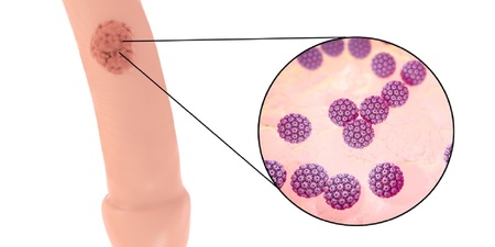 小鮮肉染「菜花」被指亂搞　他哭訴：我是處男｜每日健康 Health