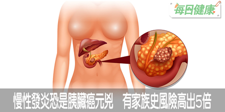 【最兇癌症】慢性發炎恐是胰臟癌元兇　有家族史風險高出5倍｜每日健康 Health