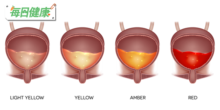 不只血尿、泡沫尿代表腎臟出問題　原來無色尿液才真的要命｜每日健康 Health