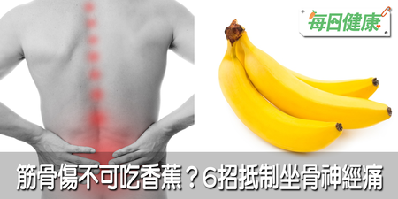 筋骨傷不可以吃香蕉？「健骨6要點」抵制坐骨神經痛，讓你站得久跑得快｜每日健康 Health