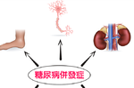 糖尿病乃萬病之母！預防腎病變、視網膜病變等8大重症該怎麼吃一次看懂