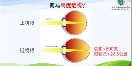 600度近視不治療，醫師警告：10年後視力只剩下「0.1」｜每日健康 Health