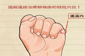 經常落枕、肩頸痠痛？中醫一招「按揉後溪穴」活血通絡能自救