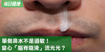 流鼻水不一定是鼻過敏，單側鼻水恐是「腦漿測漏」｜每日健康 Health