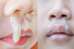 什麼顏色的鼻涕最糟糕？黃鼻涕就是鼻竇炎？兒科權威一次解答
