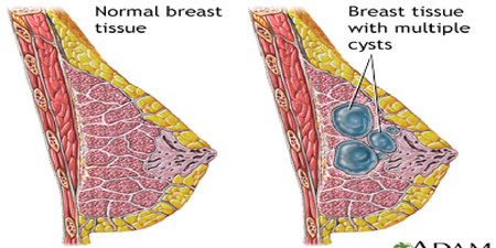乳房大小不重要，健康才是美乳關鍵！對抗「乳癌」、「乳房纖維囊腫」，吃這5種就對了！