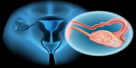 「卵巢早衰」更年期就來！女人千萬當心6大危險因子｜每日健康 Health