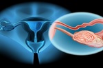 「卵巢早衰」更年期就來！女人千萬當心6大危險因子｜每日健康 Health
