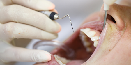 牙齦出血、變色？醫師揭「牙周病」十大併發症：中風、罹癌機率多3倍