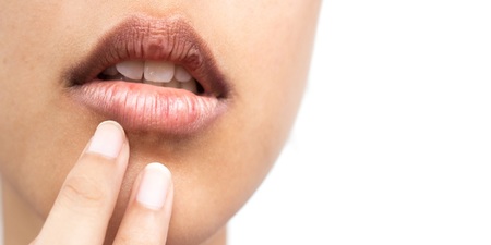 看「唇色」知健康？醫師專業解析嘴唇顏色和健康的兩種關係