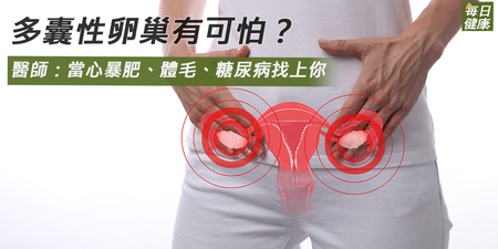 多囊性卵巢有可怕？　醫師：當心暴肥、體毛、糖尿病找上你