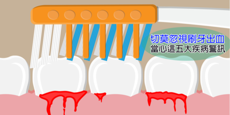 牙齦出血是牙周病前兆？牙醫提醒：還有五種疾病警訊更危險！