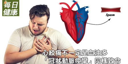 年輕人要當心，「冠狀動脈痙攣」可怕程度不輸心肌梗塞