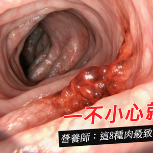 8種肉別吃太多 嚴重恐致癌或高血壓