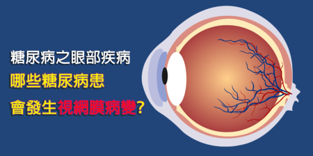 哪些糖尿病患可能引起視網膜病變？眼科醫師提醒「兩種人」要定期追蹤檢查