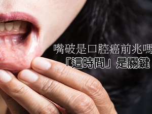 口腔癌4大早期症狀大揭密？「嘴破」整個月要小心