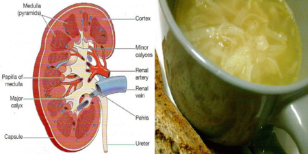 腎乾淨，人就年輕！每天來杯「洋蔥湯」排出廢物、預防泌尿道感染，讓你的腎煥然一新。